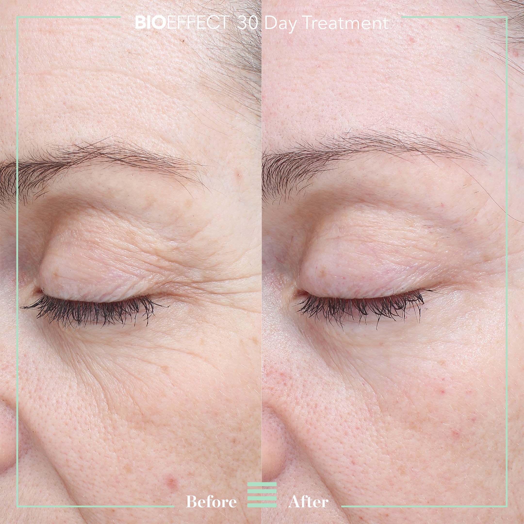 30 Day Treatment - Image 2