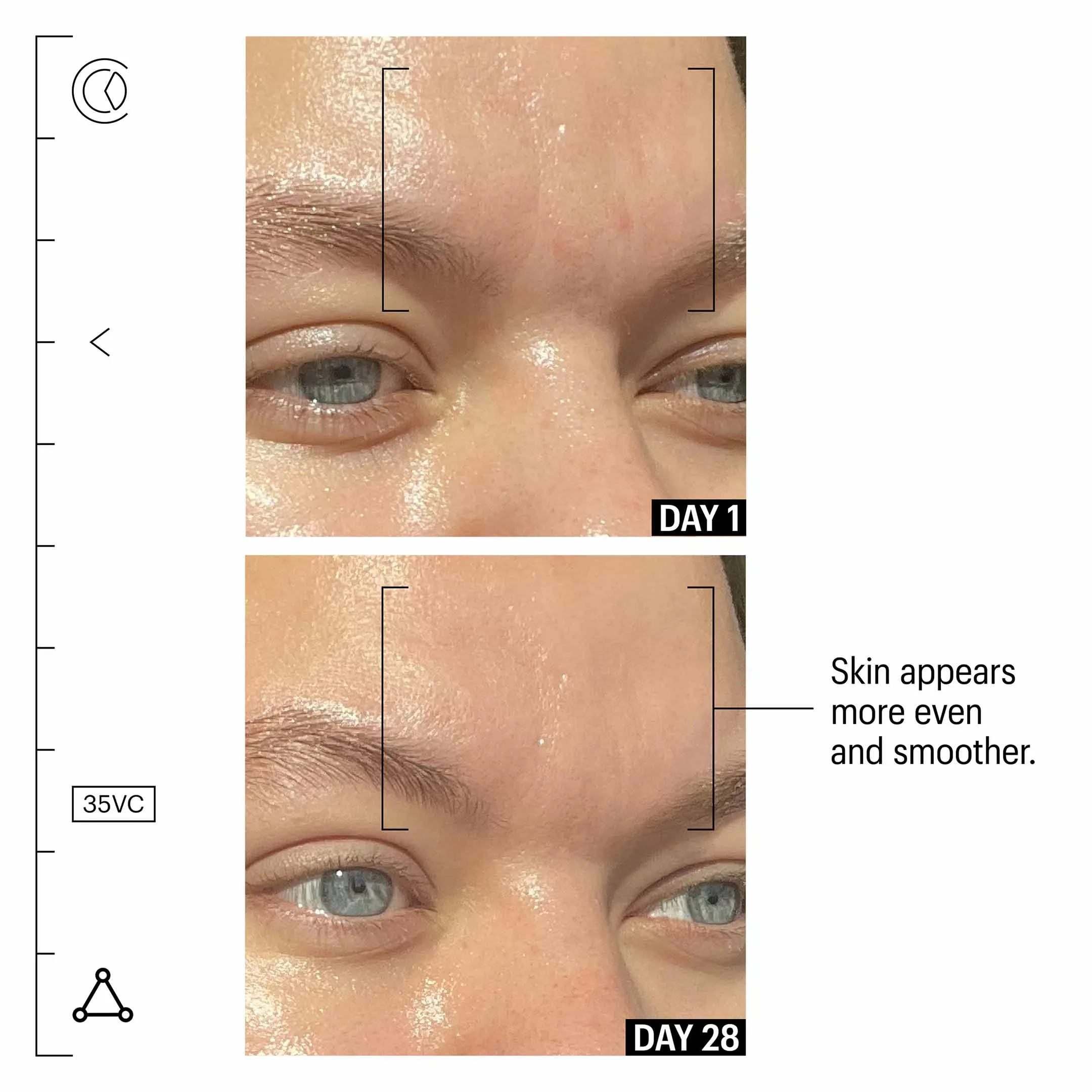 35% Vitamin C+ Perfecting Serum - Image 3