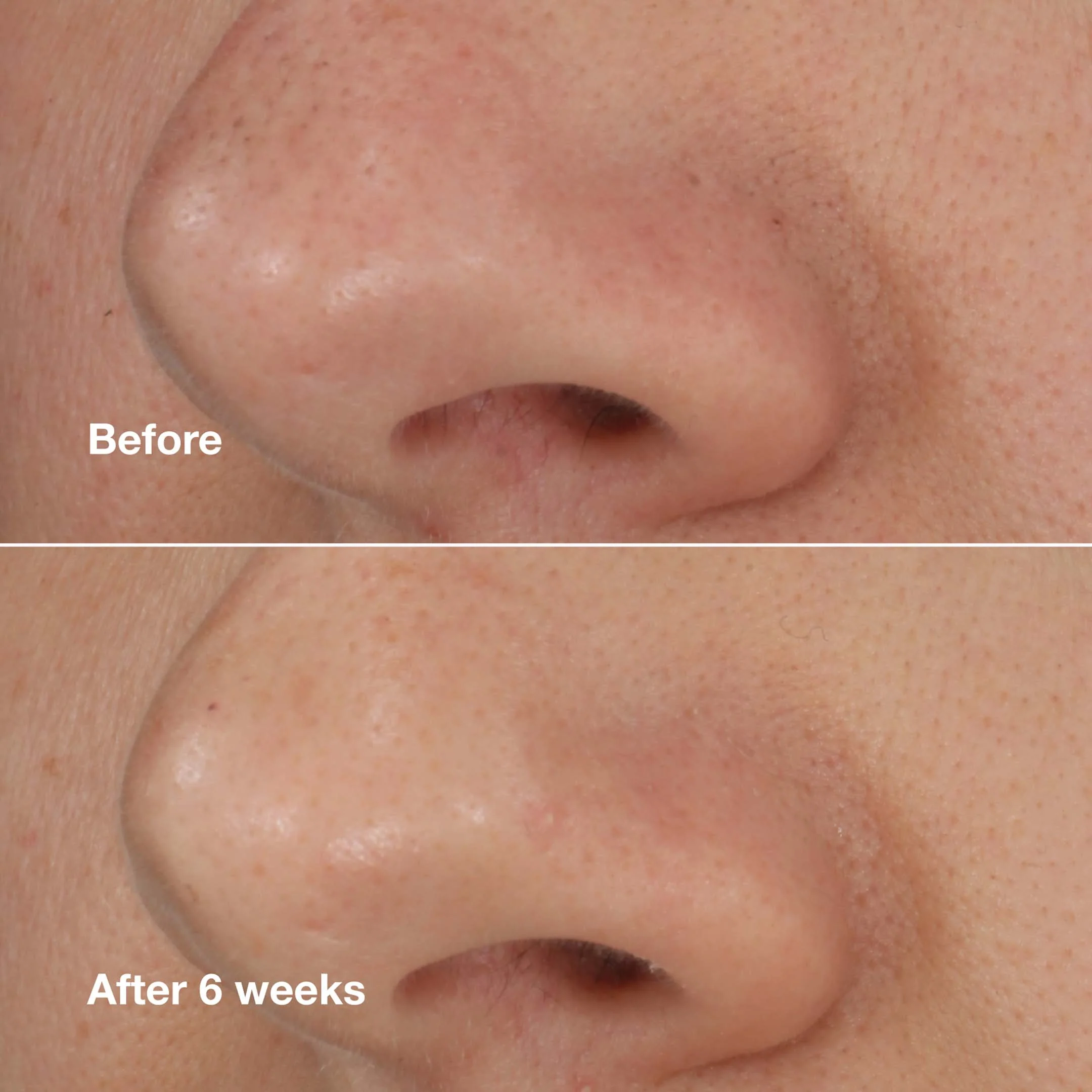 CLARIFYING LOTION TWICE A DAY EXFOLIATOR 2 400 ML - Image 3