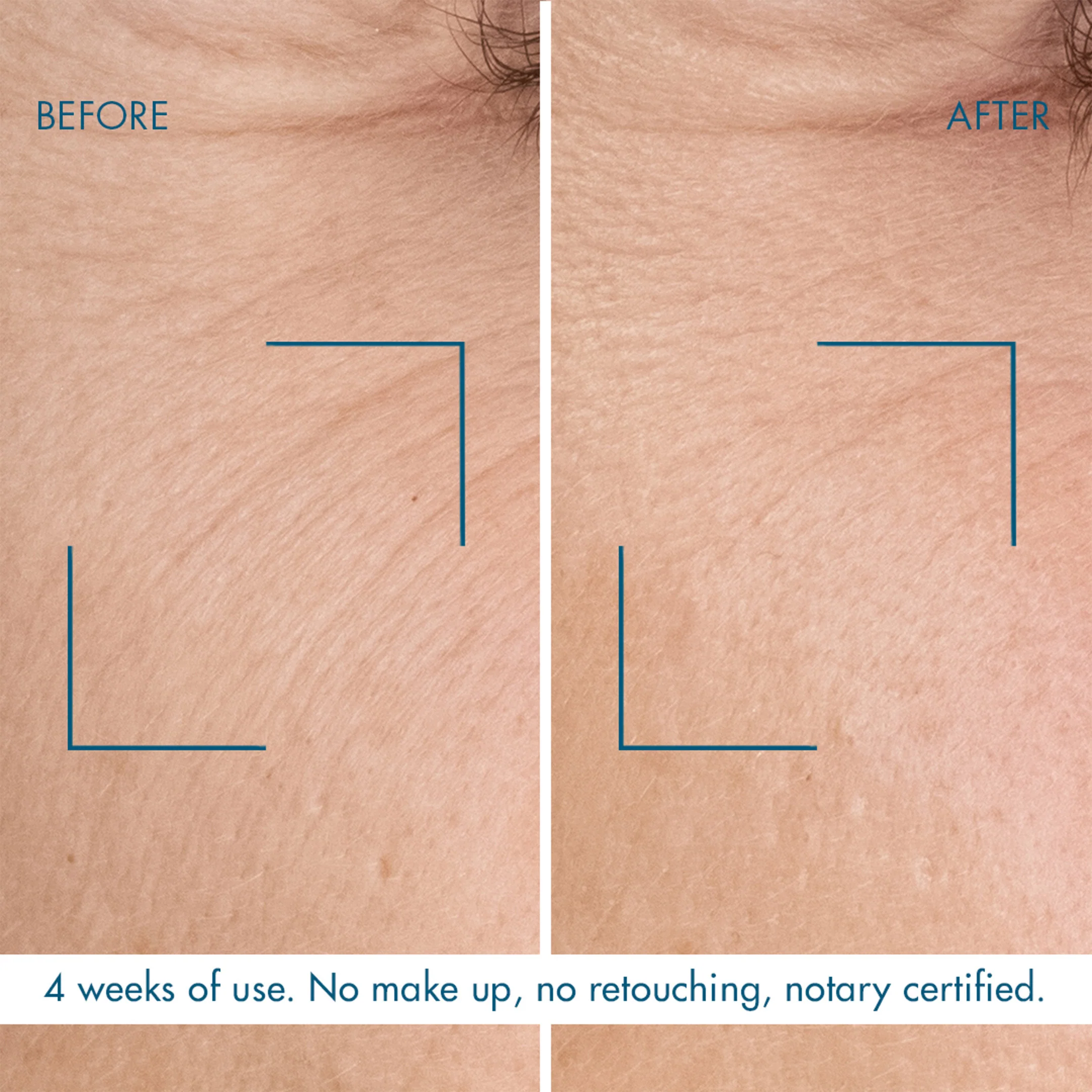 Blue Retinol Night Serum - Image 2