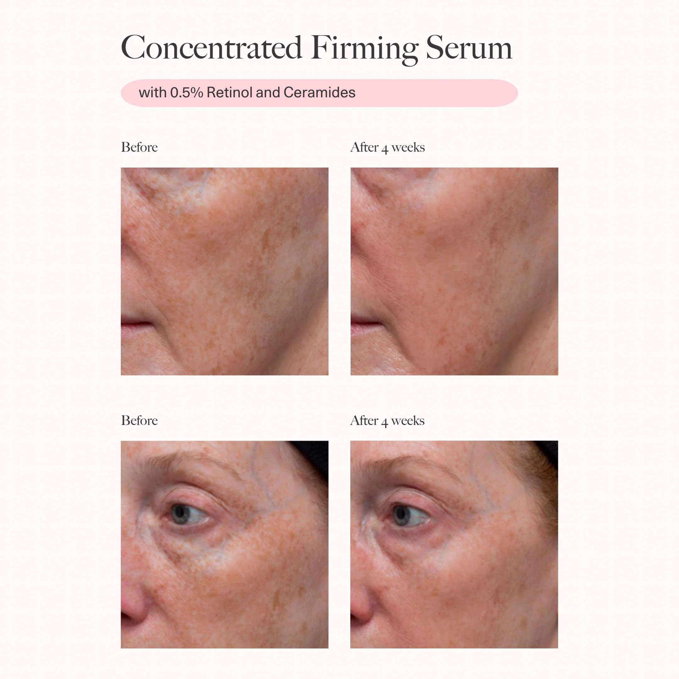 Concentrated Firming Serum - Image 3