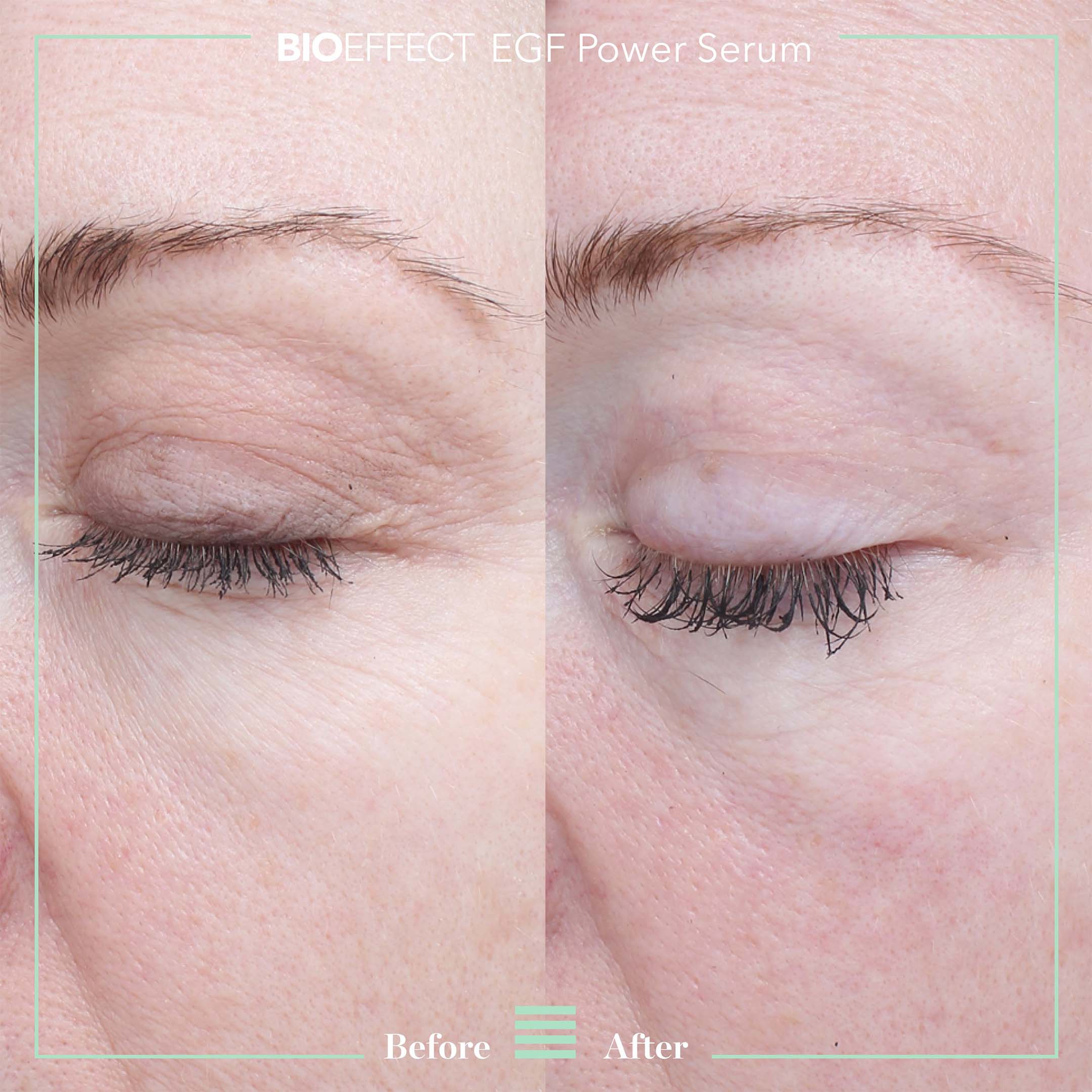 EGF POWER SERUM (15ml) - Image 4
