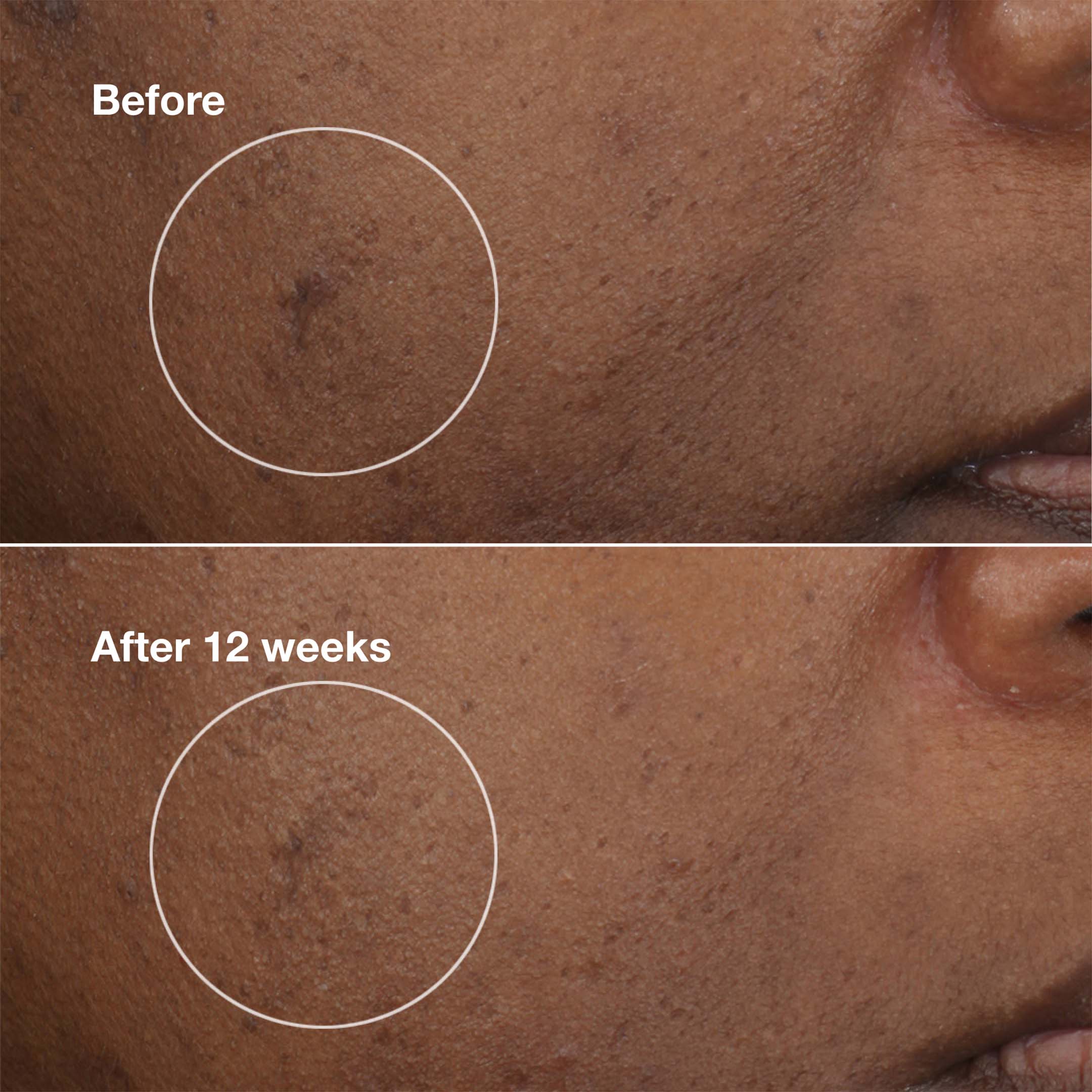 EVEN BETTER EYES™ DARK CIRCLE CORRECTOR 10 ML - Image 3