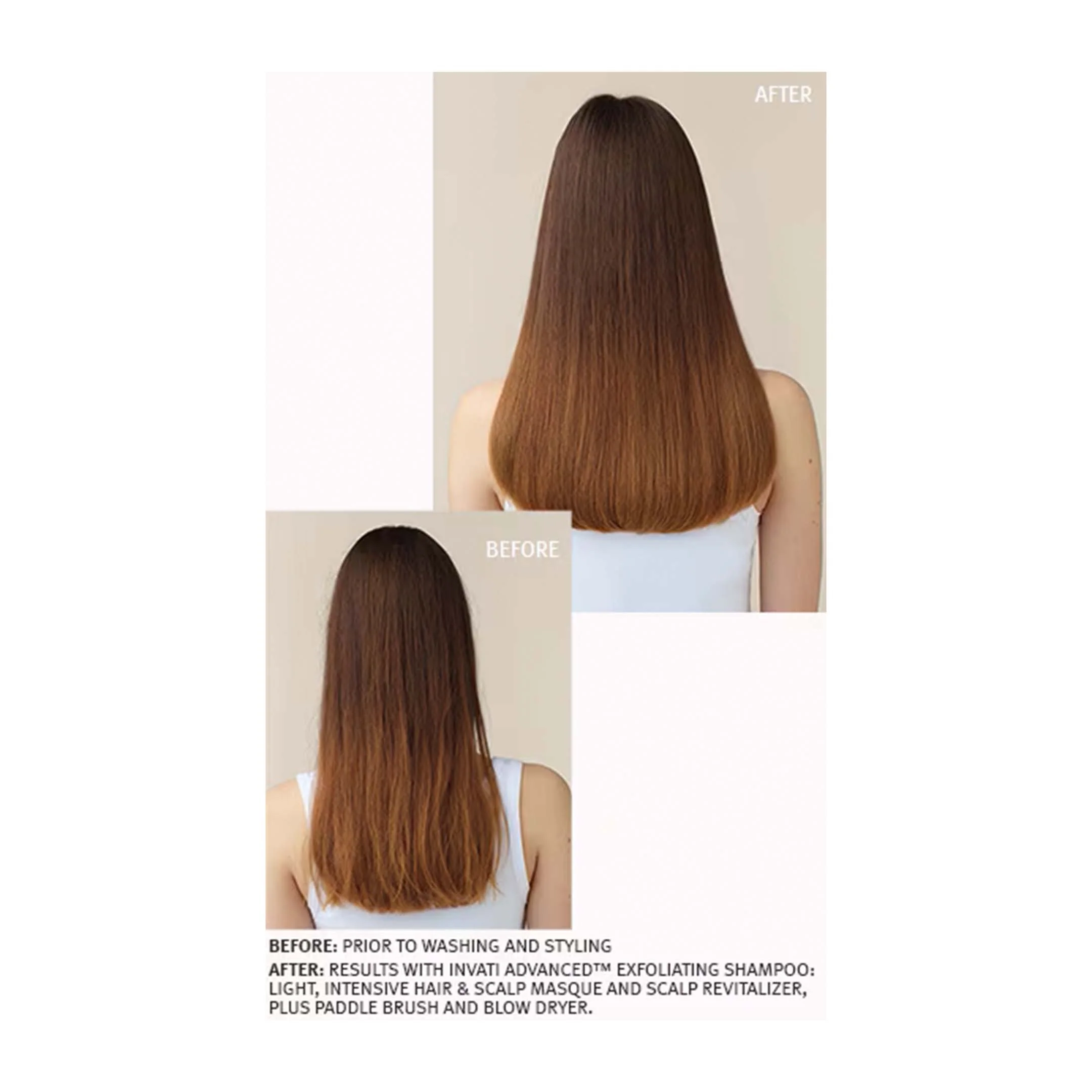 Invati Advanced⢠System Set Light - Image 2