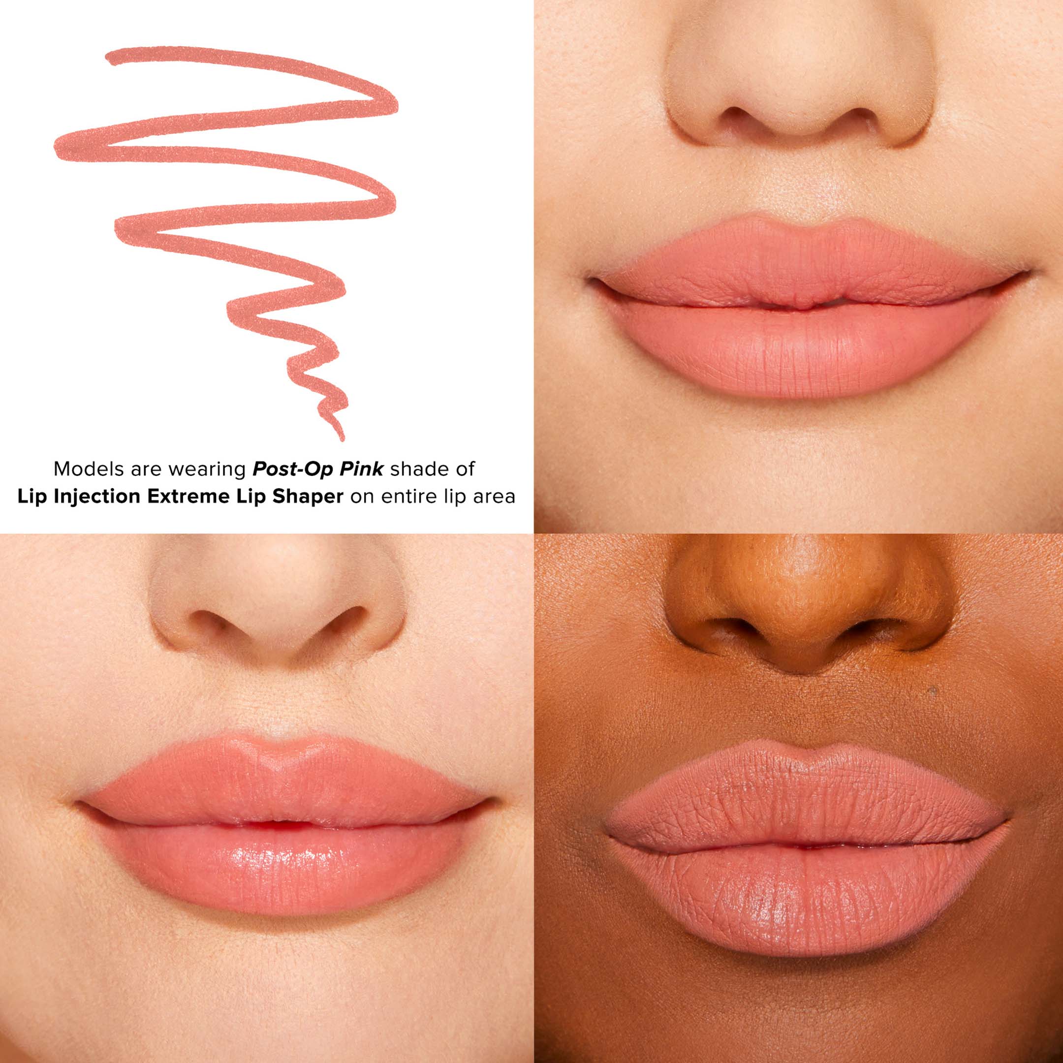 Lip Injection Lip Shaper - Image 3