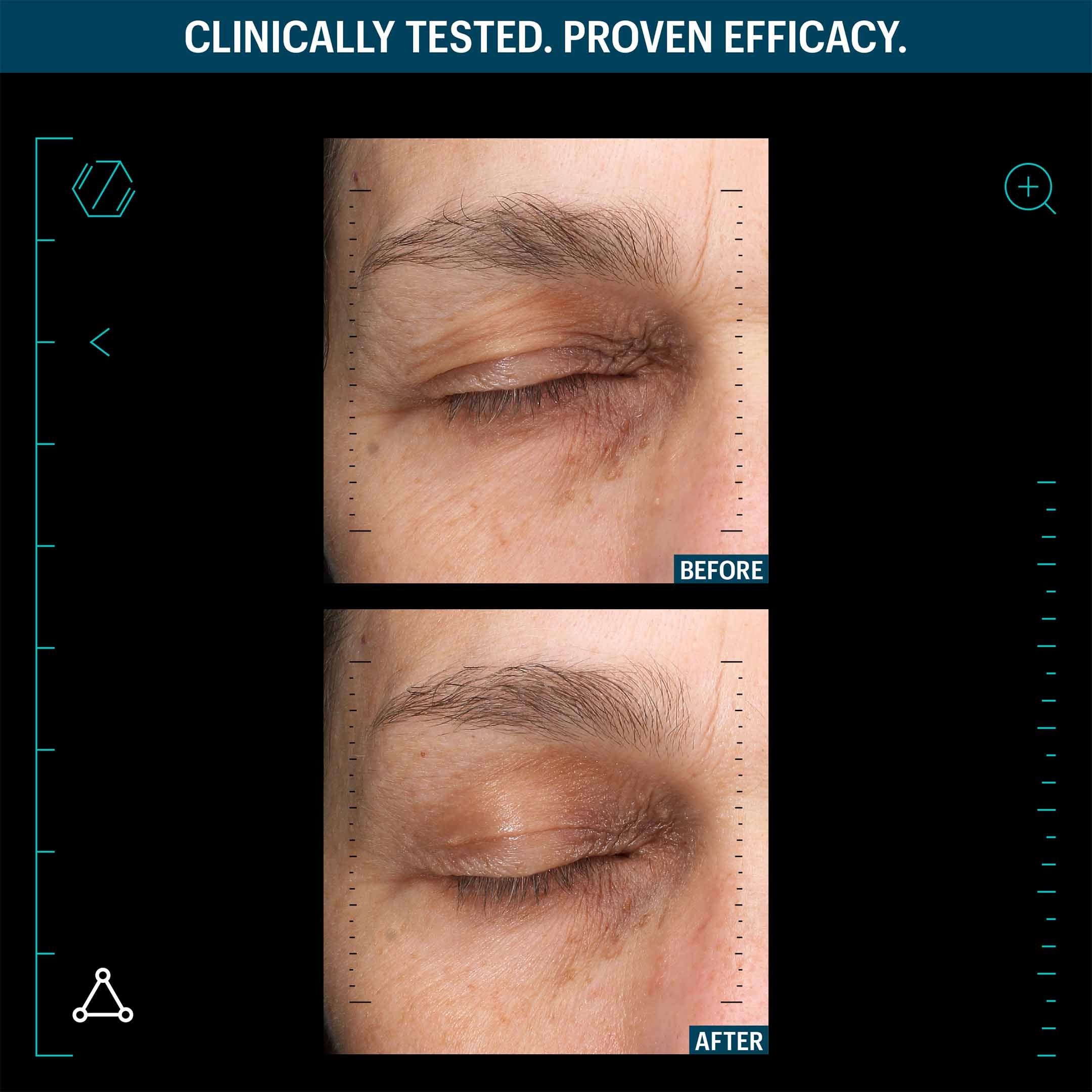 Multi Peptides & Gf Advanced Lifting Serum - Image 5