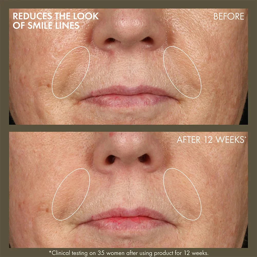Plantscriptionâ„¢ Active Wrinkle Correction Serum With Retinoid - Image 3