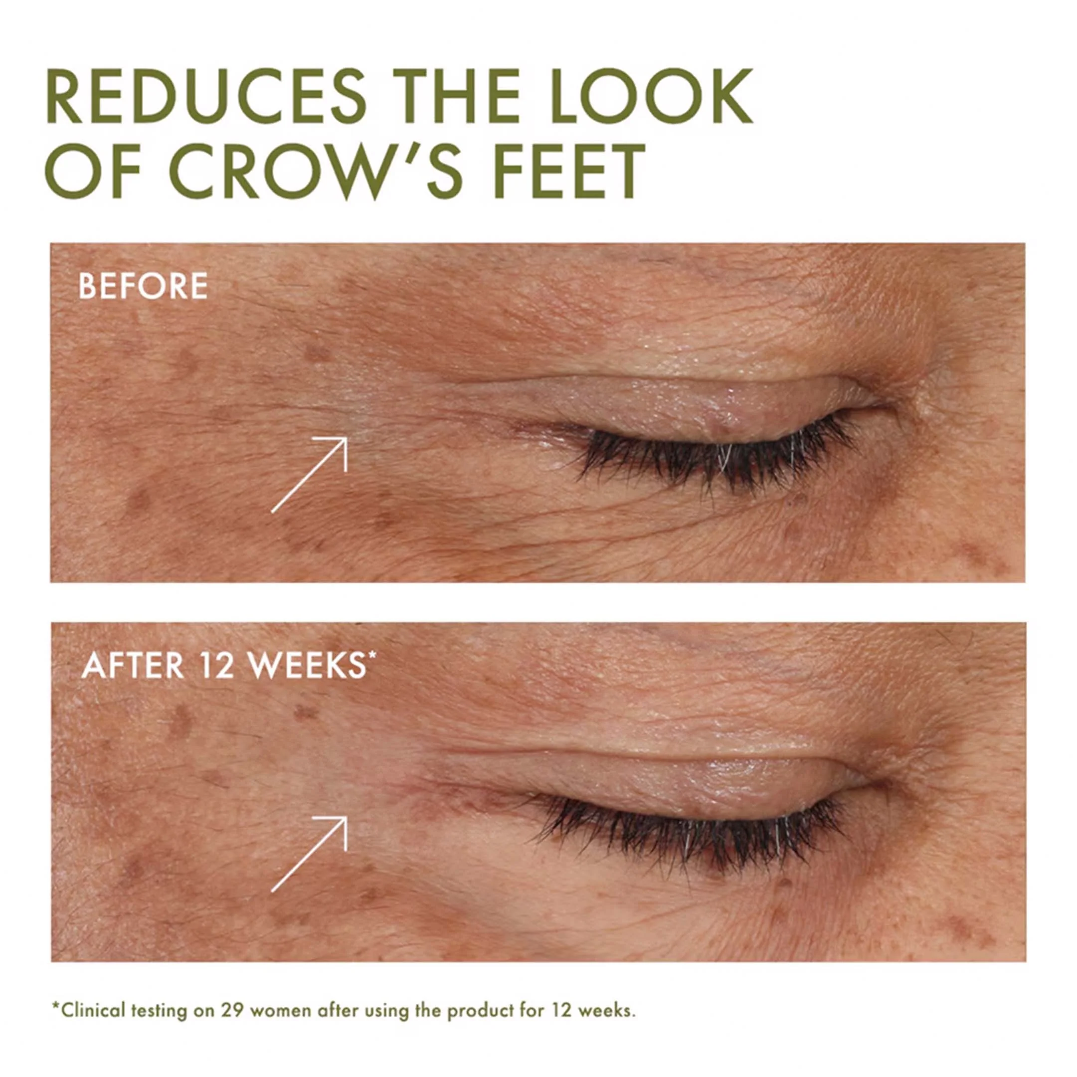 Plantscriptionâ„¢ Wrinkle Correction Eye Cream With Encapsulated Retinol - Image 4