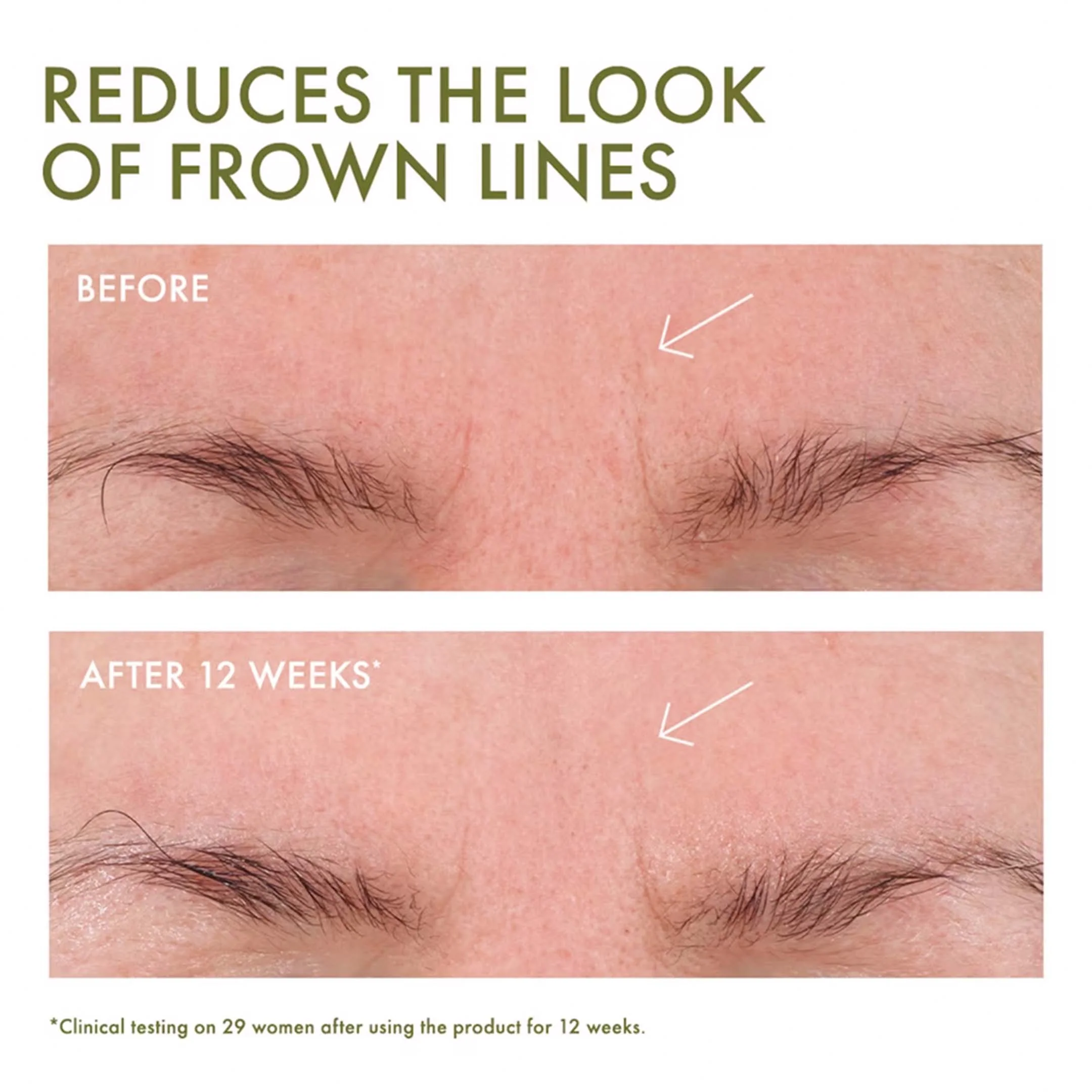 Plantscriptionâ„¢ Wrinkle Correction Eye Cream With Encapsulated Retinol - Image 5
