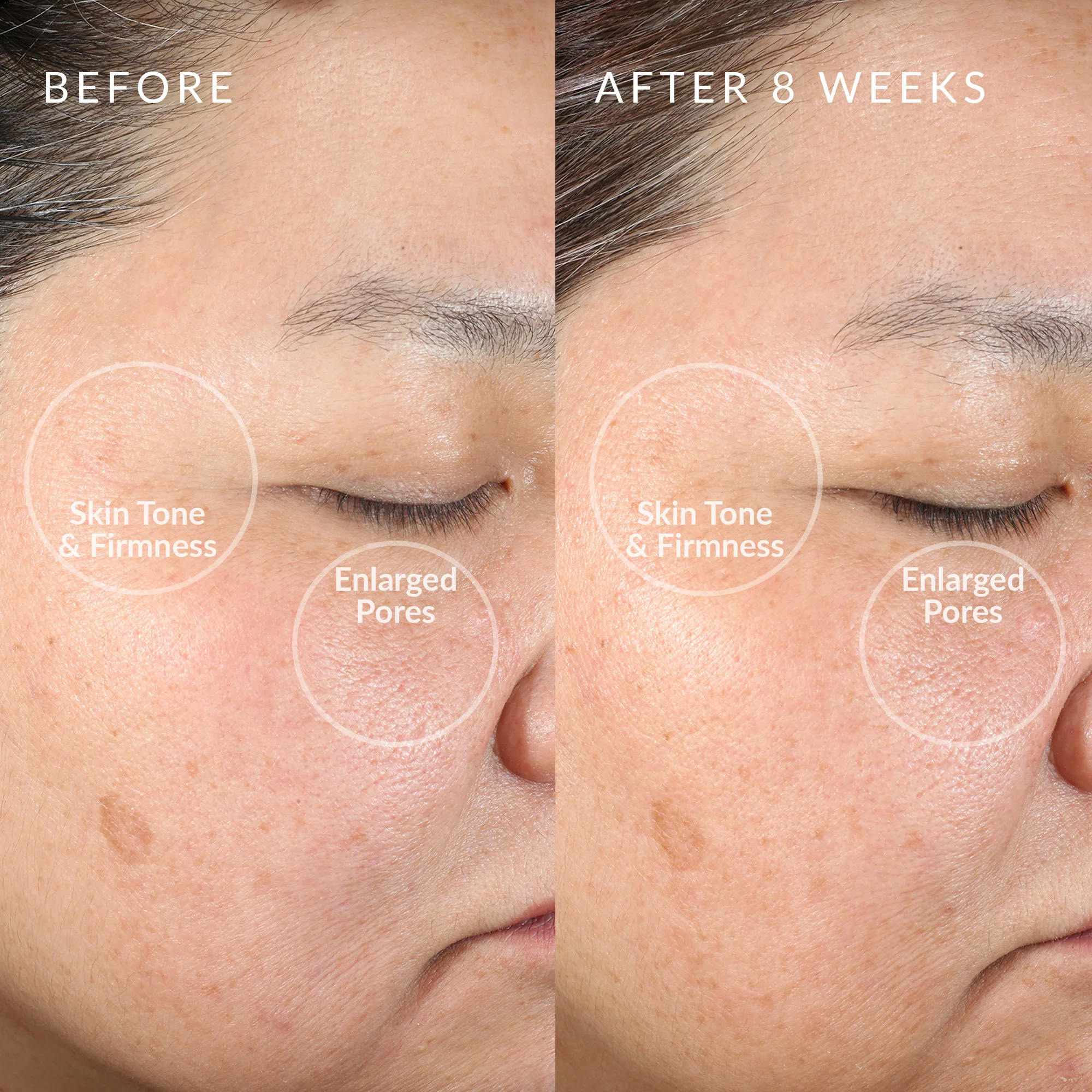 PMD Clean - Smart Facial Cleansing Device - Image 5