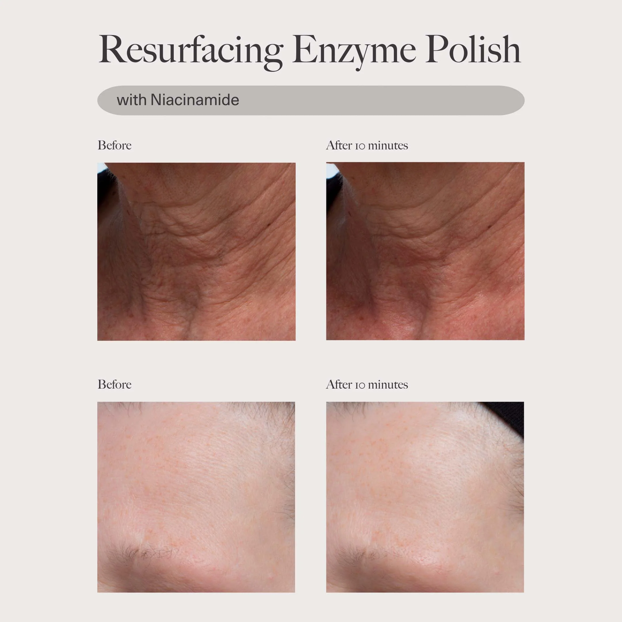 Resurfacing Enzyme Polish - Image 4