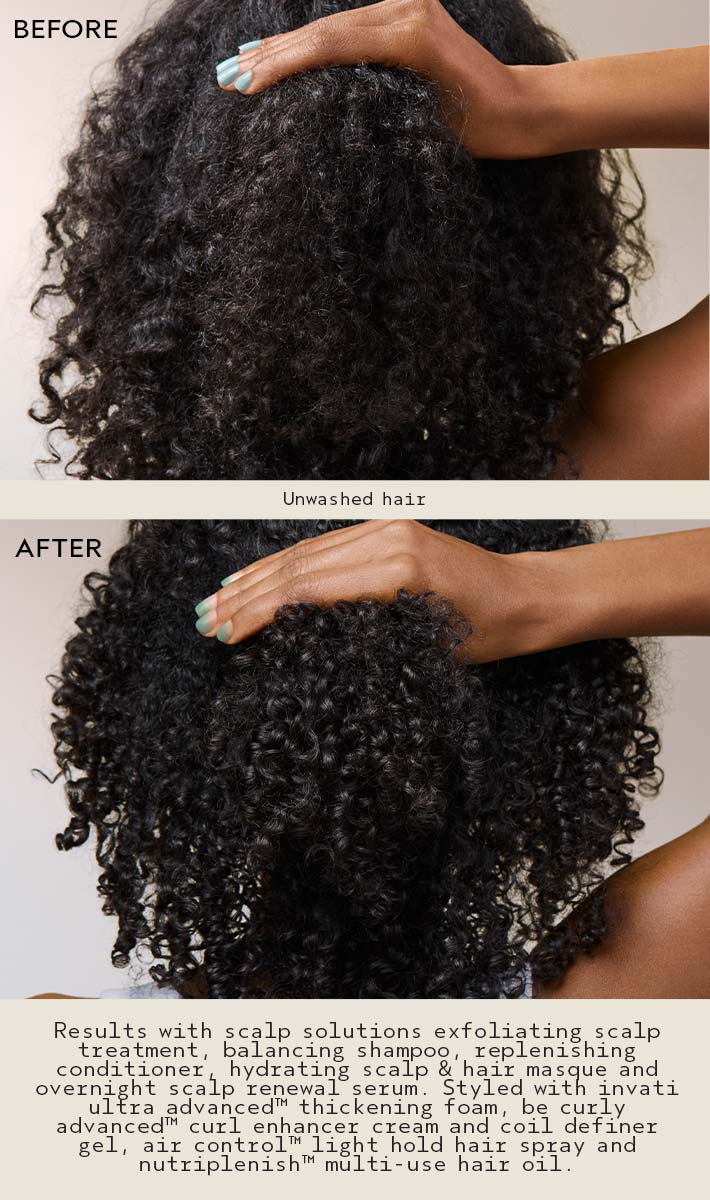 Scalp Solutions™  Hydrating Scalp & Hair Masque - Image 5