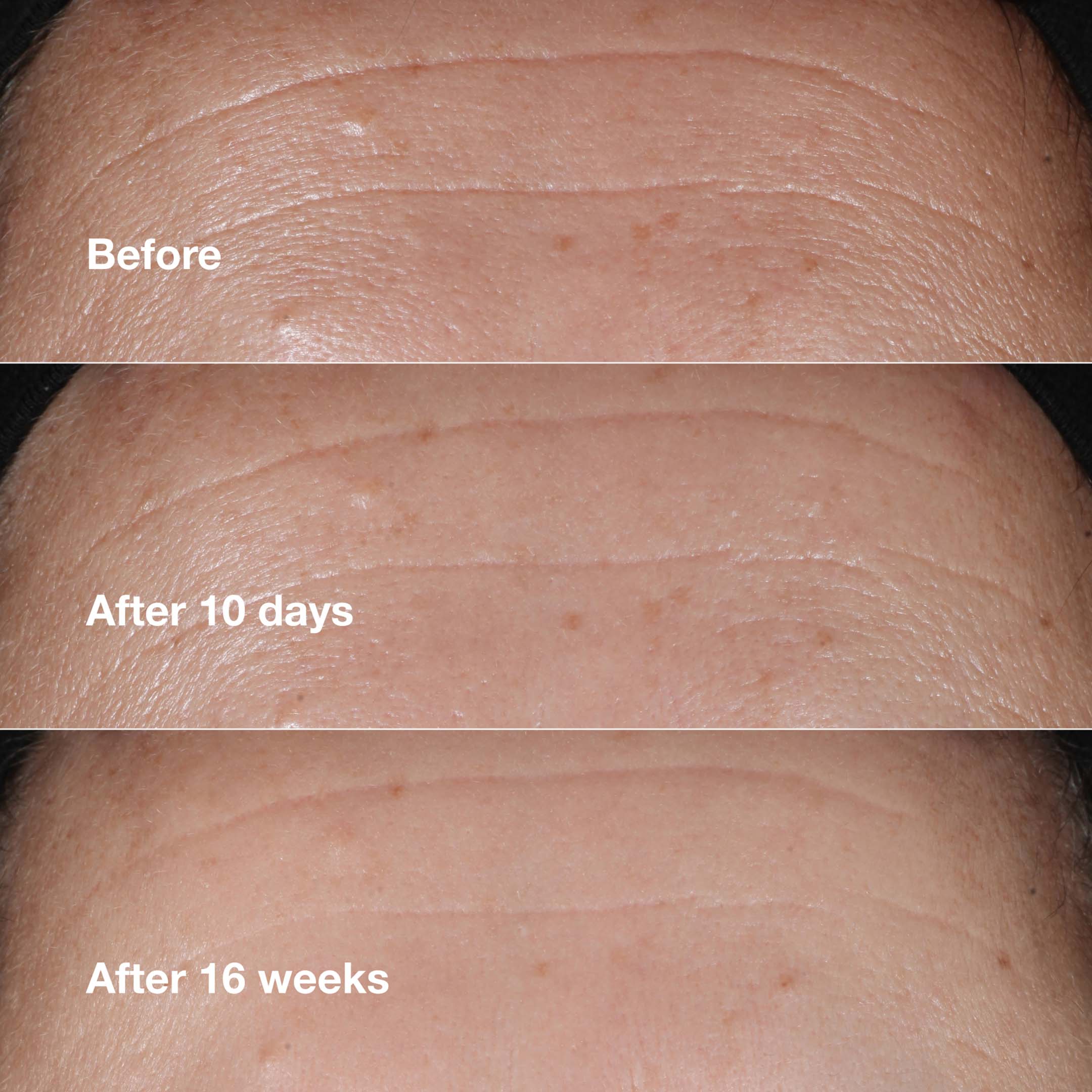 Smart Clinical Repair™ Wrinkle Correcting Serum - Image 3