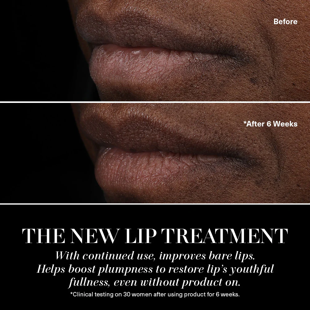 The Lip Treatment - Image 5