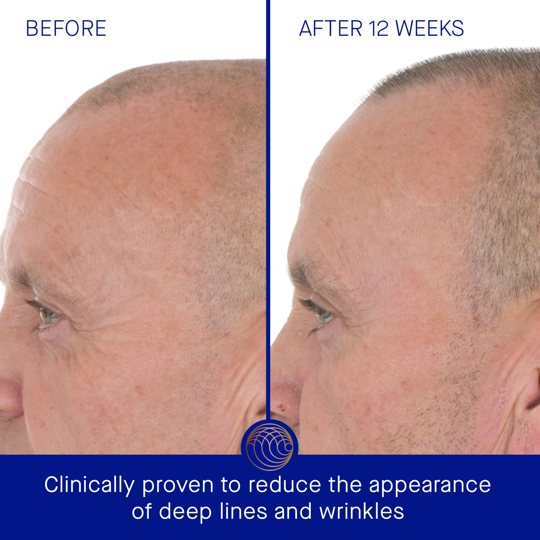The Retinol Serum - Image 3