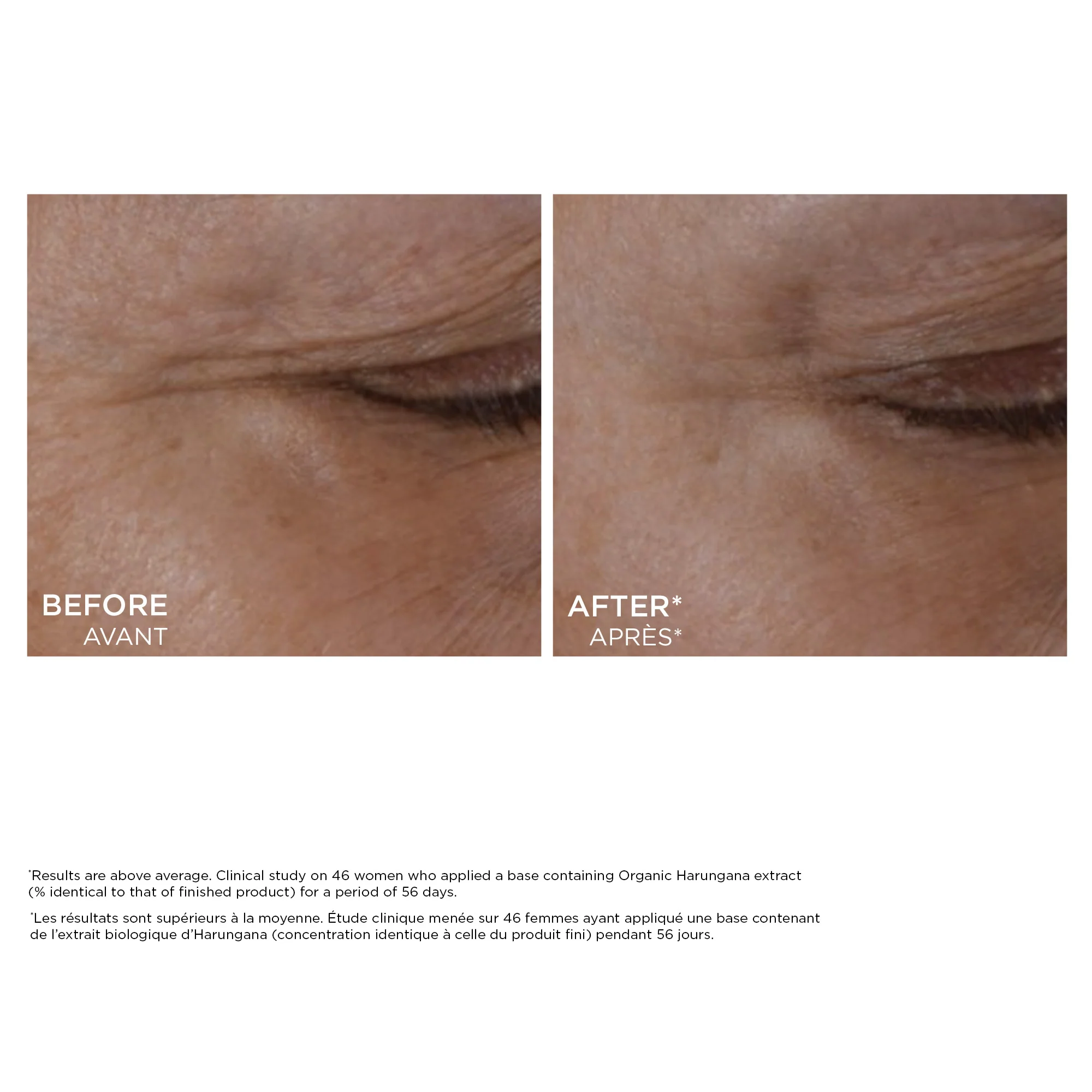 Total Eye Lift - Image 2