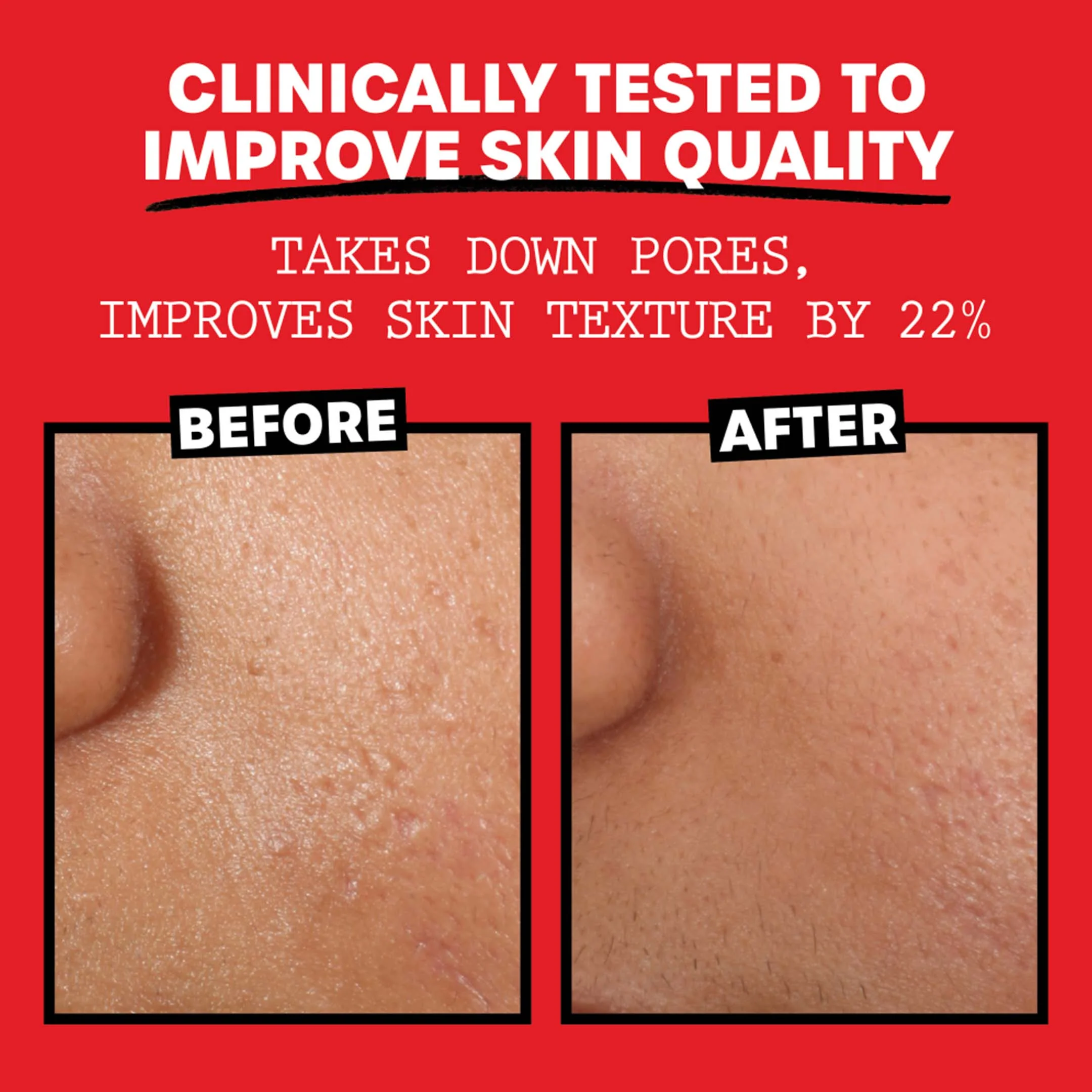 Unscented Witch Hazel Toner - Image 18