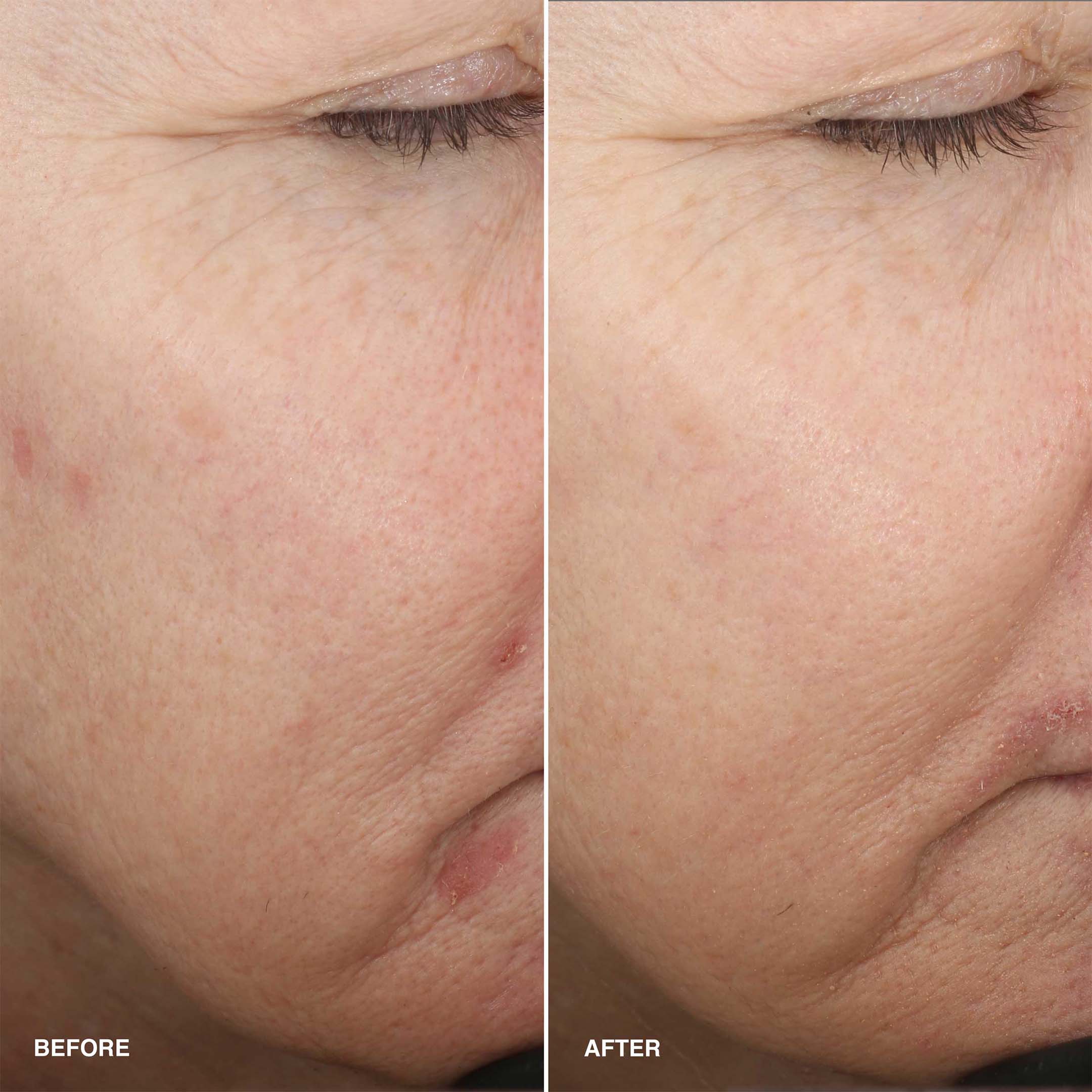 Vitamin Enriched Smoothing Serum - Image 4